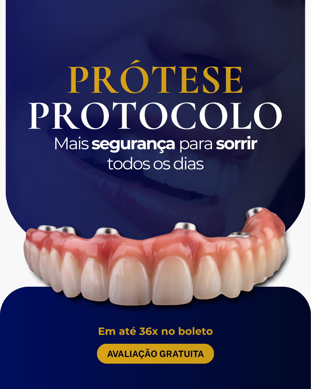 Criativo para prótese protocolo com destaque para segurança ao sorrir